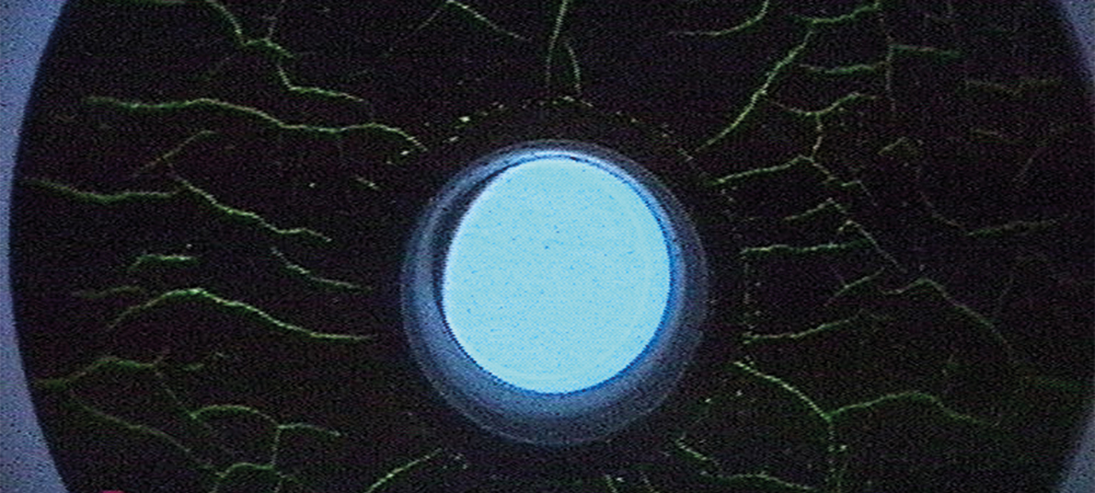 magnetic particle testing with UV endoscope magnetic particle testing with UV endoscope